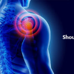 Shoulder pain relief is within your reach